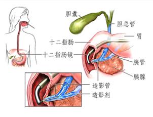 u=1893440055,4035532489&fm=27&gp.jpg